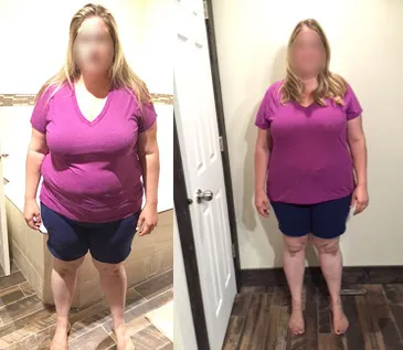 Hailey before and after, down 30 pounds in 6 weeks